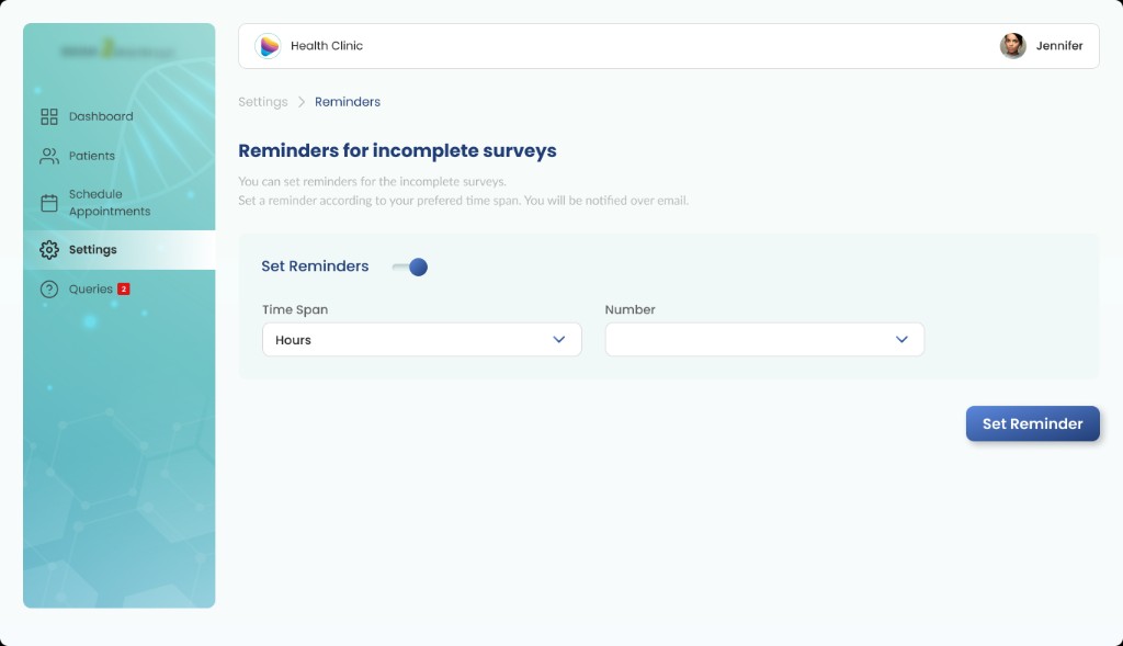 Reminders settings for incomplete surveys